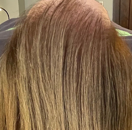 Before/After Image